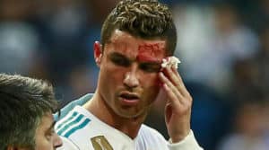 Read more about the article Watch: Real Madrid treat Ronaldo’s head wound
