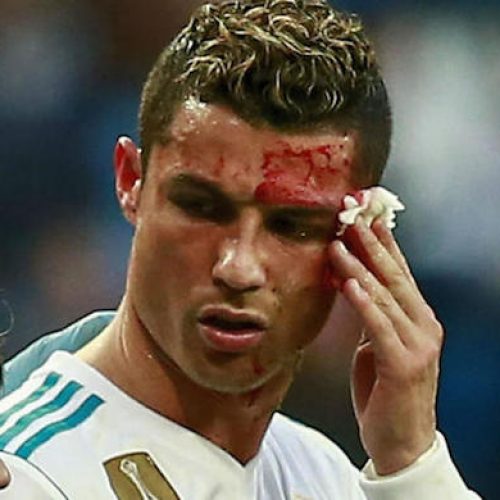 Watch: Real Madrid treat Ronaldo’s head wound