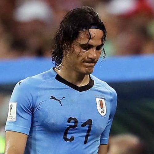 Cavani hopes calf injury ‘is nothing’